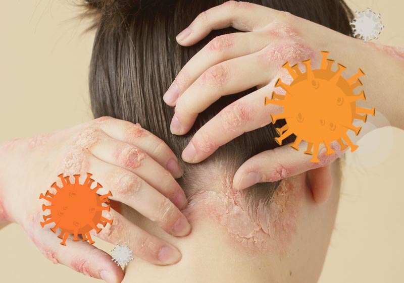 Immune disorders Stem Cell Treatment