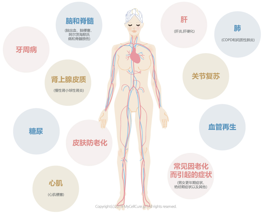 干细胞治疗适用范围